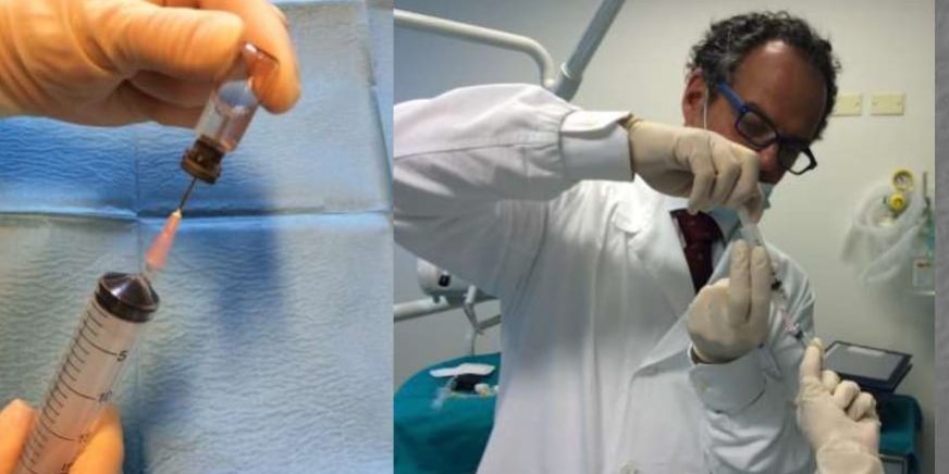 patologia alla mandibola3