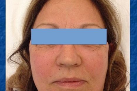 presentazione-paziente