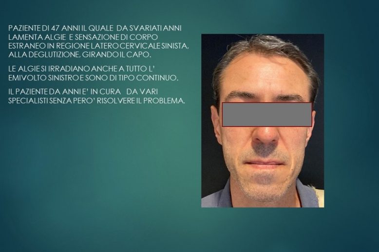 eagle-esterno – presentaione caso