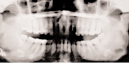 Screenshot 2022-12-20 at 18-10-34 View of Temporomandibular joint examination reviewed