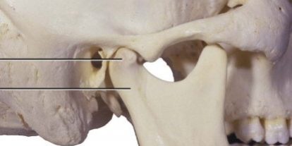 Condilo Mandibolare infiammato o fratturato - dr. Luca Guarda Nardini