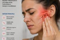 Artrite psoriasica