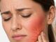 - dente del giudizio può danneggiare il nervo alveolare inferiore
